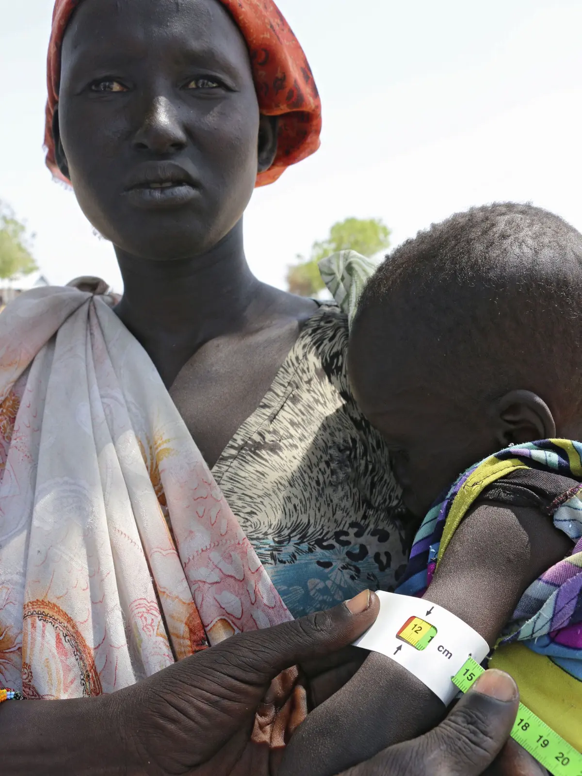 Vereinte Nationen beklagen grosses Ausmass des weltweiten Hungers: Bei einem Baby wird in Thonyor Payam im Bundesstaat Unity im Suedsudan der Armumfang gemessen (Archivbild). Der weltweite Hunger verharrt laut den Vereinten Nationen auf einem verheerend hohen Niveau und bedroht das Leben vieler Menschen. Im Jahr 2023 seien rund 9,1 Prozent der Weltbevoelkerung oder 733 Millionen Menschen von Hunger betroffen gewesen, teilten die UN am Mittwoch in Rio de Janeiro mit. (Siehe epd-Meldung vom 24.07.2024) *** Local Caption *** 00369007