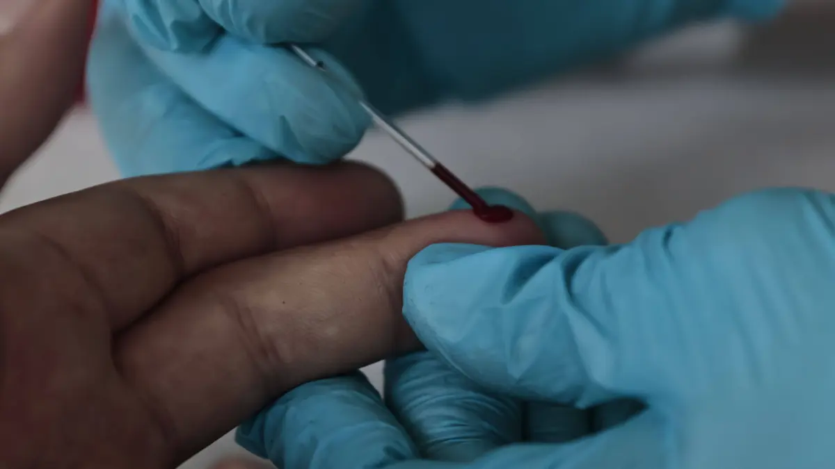 Bei dem Test wird an der Fingerkuppe ein Tropfen Blut entnommen.