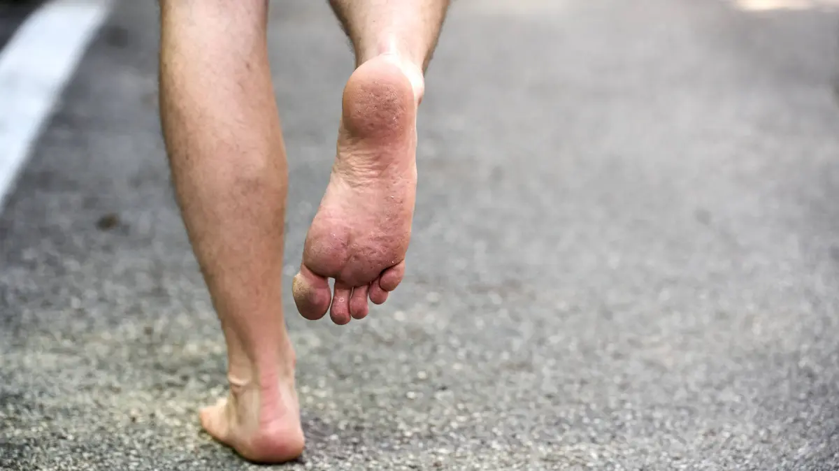 Eine Person läuft barfuß, also ohne Schuhe, auf einem gepflasterten Weg läuft, wodurch der direkte Hautkontakt mit der Erde betont wird und Abdrücke im Fuß in der Haut sichtbar sind. Barfußlaufen fördert die natürliche Verbindung zur Natur und bietet ein Gefühl von Freiheit und Entspannung und ist gut für die Gesundheit und Durchblutung.