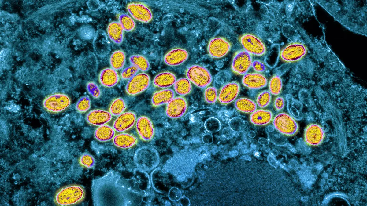 Als Pocken, Blattern oder Variola (lateinisch variolae), genannt auch Pockenkrankheit, bezeichnet man eine für den Menschen gefährliche und lebensbedrohliche Infektionskrankheit, die von Pockenviren (Orthopox variolae) verursacht wird.