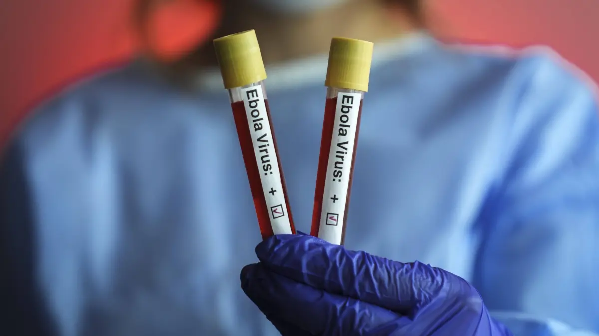Ebolafieber ist eine Infektionskrankheit, die durch Viren der Gattung Orthoebolavirus hervorgerufen wird. Die Bezeichnung geht auf den Fluss Ebola in der Demokratischen Republik Kongo zurück, in dessen Nähe diese Viren 1976 den ersten allgemein bekannten großen Ausbruch verursacht hatten.