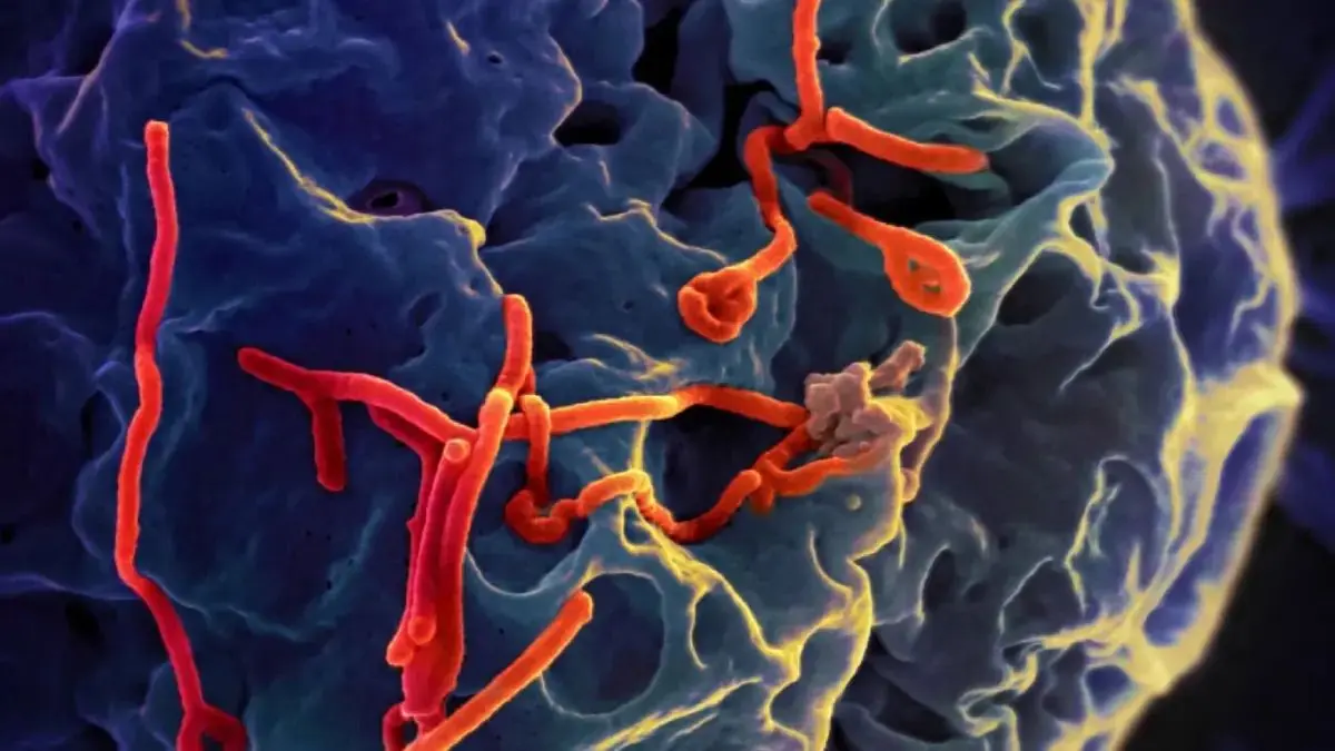 Ebolaviren-Partikel (rot) auf einer menschlichen Zelle.Foto: