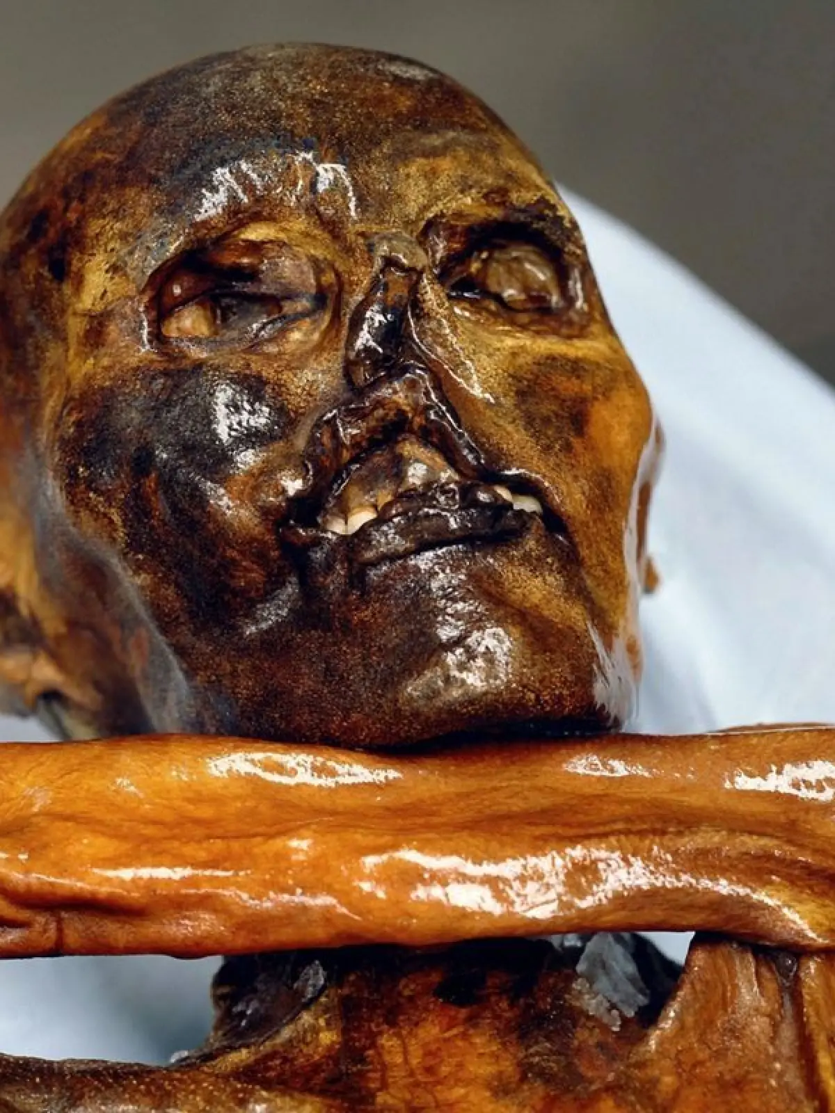 Eine Nahaufnahme des Kopfes der 5300 Jahre alten Gletscherleiche im Archäologischen Museum in Bozen (undatiertes Archivfoto).