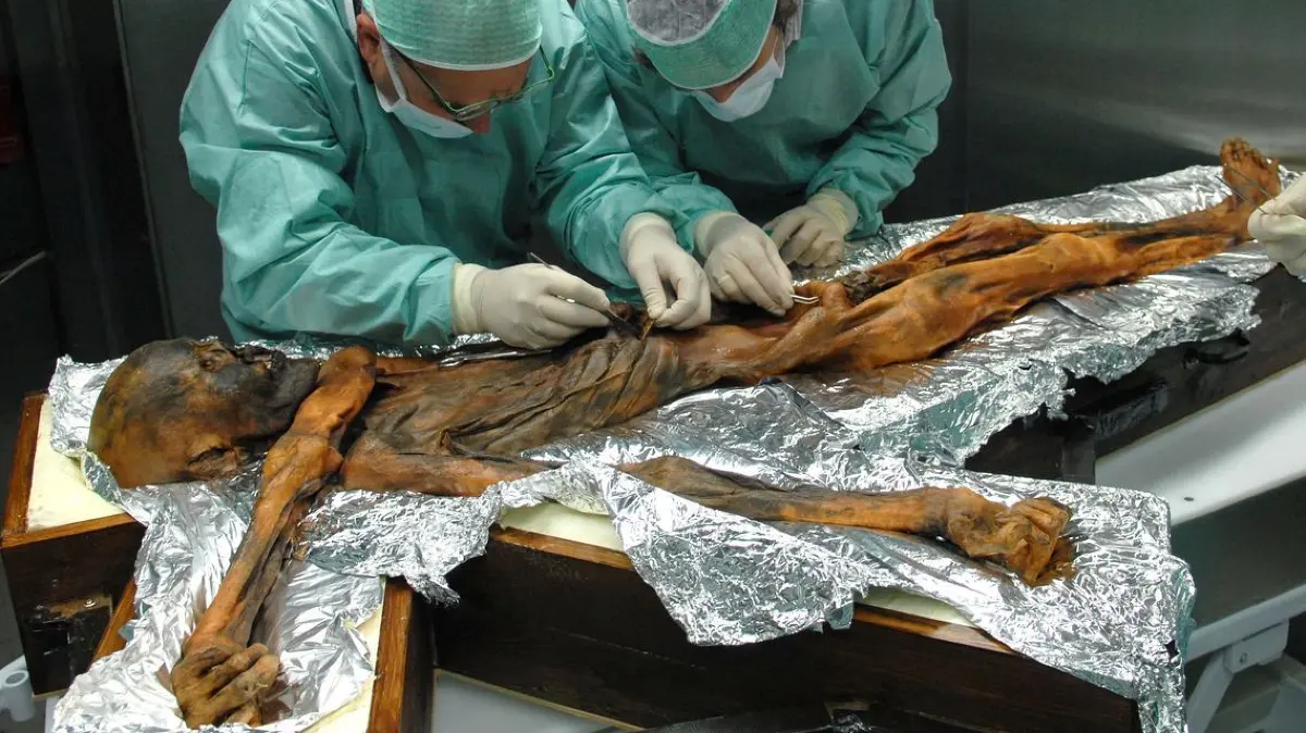 Die Wissenschaftler Eduard Egarter-Vigl (li.) und Albert Zink untersuchen die rund 5000 Jahre alte Gletschermumie "Ötzi" und entnehmen Proben des Mageninhaltes (Archivbild).